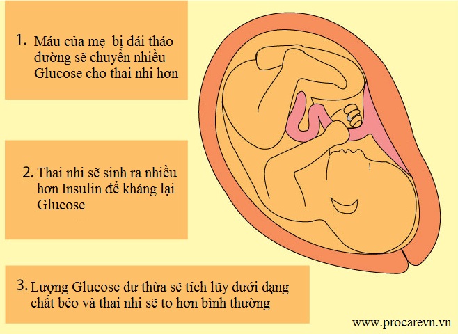 Nguy cơ cho thai nhi và trẻ sơ sinh 1