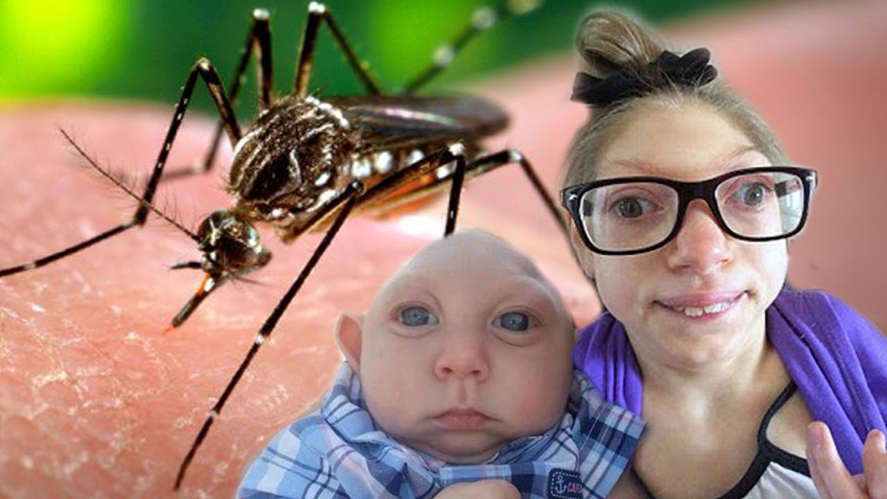 Virus Zika có thực sự gây ra hội chứng đầu nhỏ và các khuyết tật bẩm sinh khác? 1