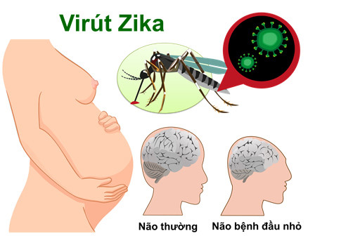 Hướng dẫn tạm thời chăm sóc phụ nữ mang thai trong bối cảnh dịch bệnh do virus Zika – Bộ Y Tế 1