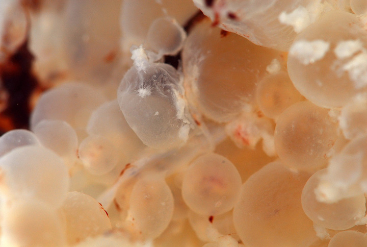 Chửa trứng 1 Chửa trứng 1