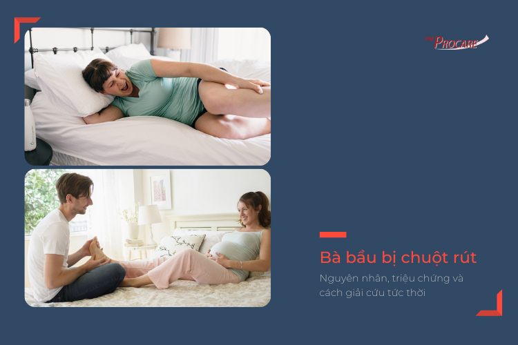 Bà bầu bị chuột rút - cách xử trí nhanh giảm cơn đau 1 Bà bầu bị chuột rút - cách xử trí nhanh giảm cơn đau 1