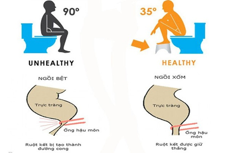 7. Thay đổi tư thế ngồi xổm khi đi vệ sinh 1 7. Thay đổi tư thế ngồi xổm khi đi vệ sinh 1