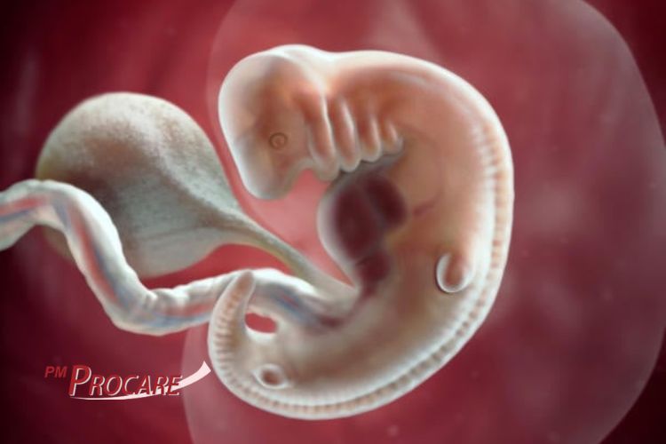 Hình ảnh siêu âm thai trứng  Vinmec