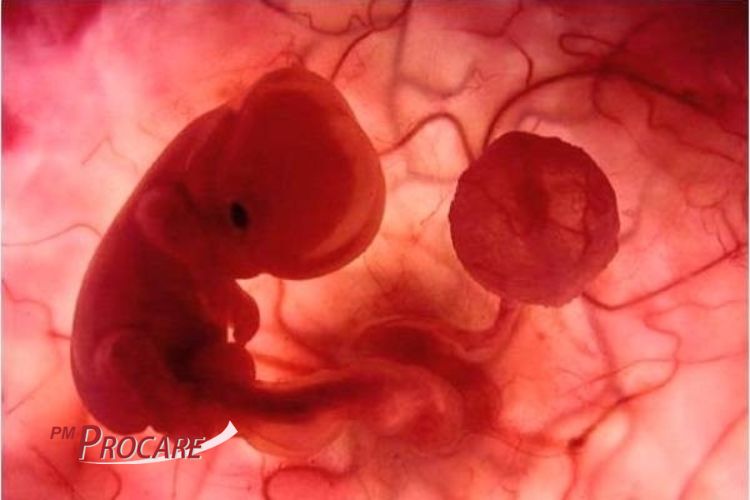 11. Thai nhi phát triển chậm trong tử cung (IUGR) 1 11. Thai nhi phát triển chậm trong tử cung (IUGR) 1