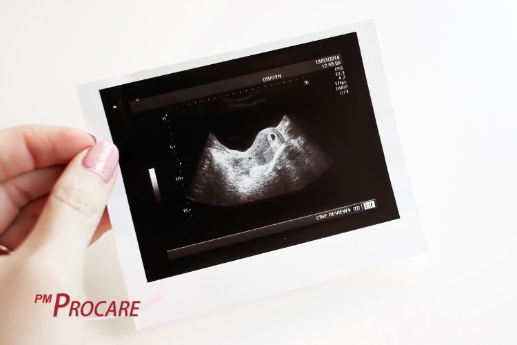 Tìm hiểu chung về siêu âm thai 1 Tìm hiểu chung về siêu âm thai 1